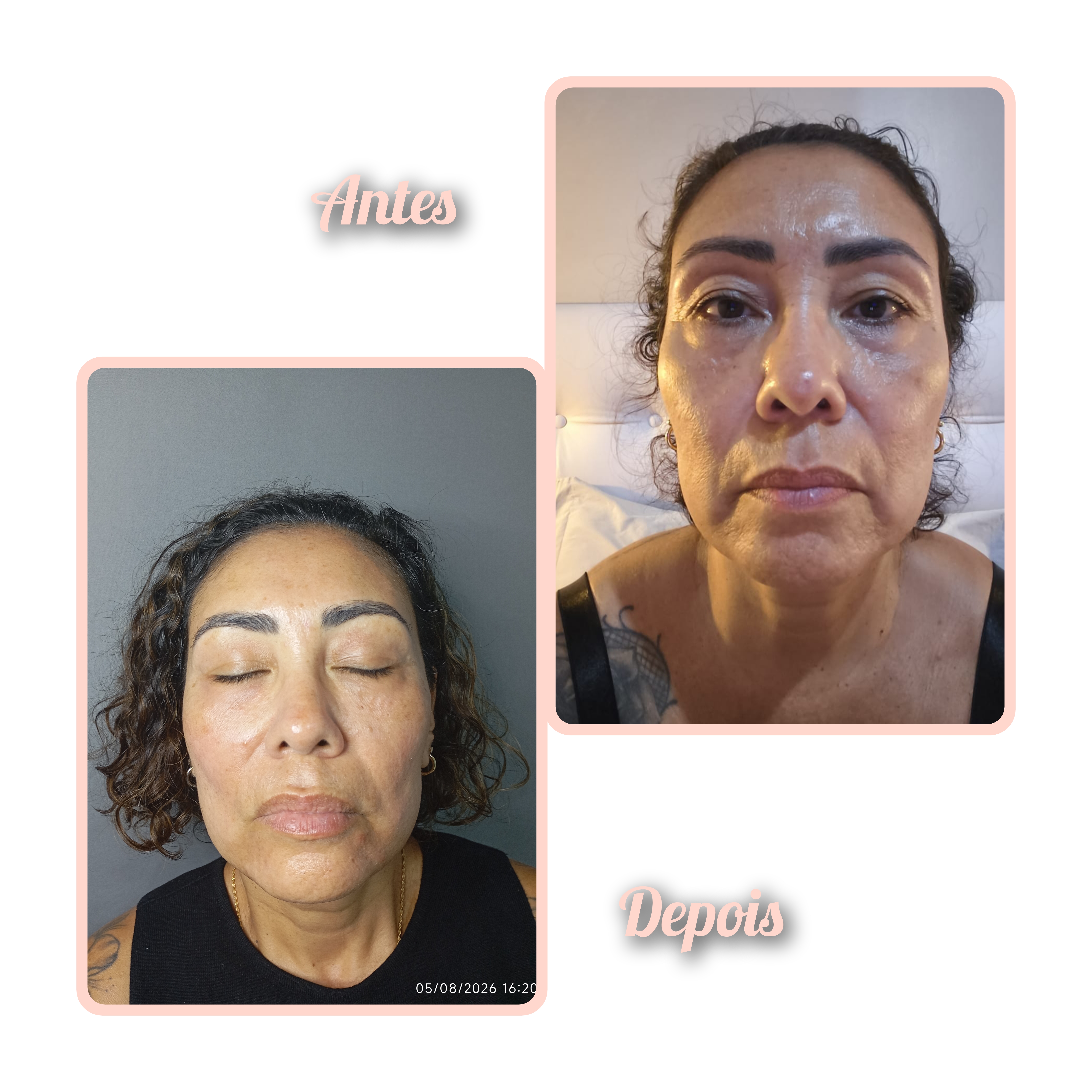 Studio Eliene (Limpeza de Pele) — foto 8