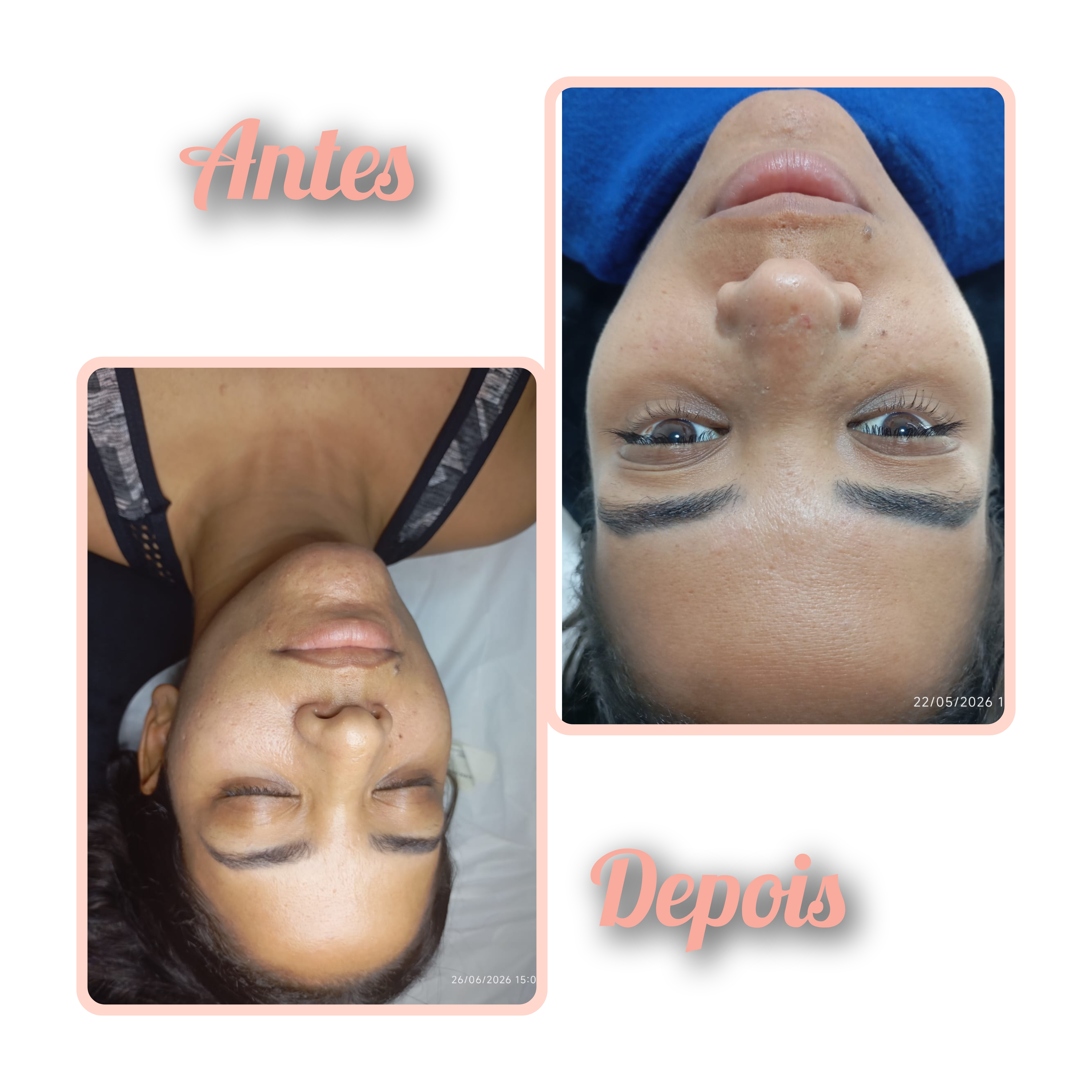 Studio Eliene (Limpeza de Pele) — foto 7