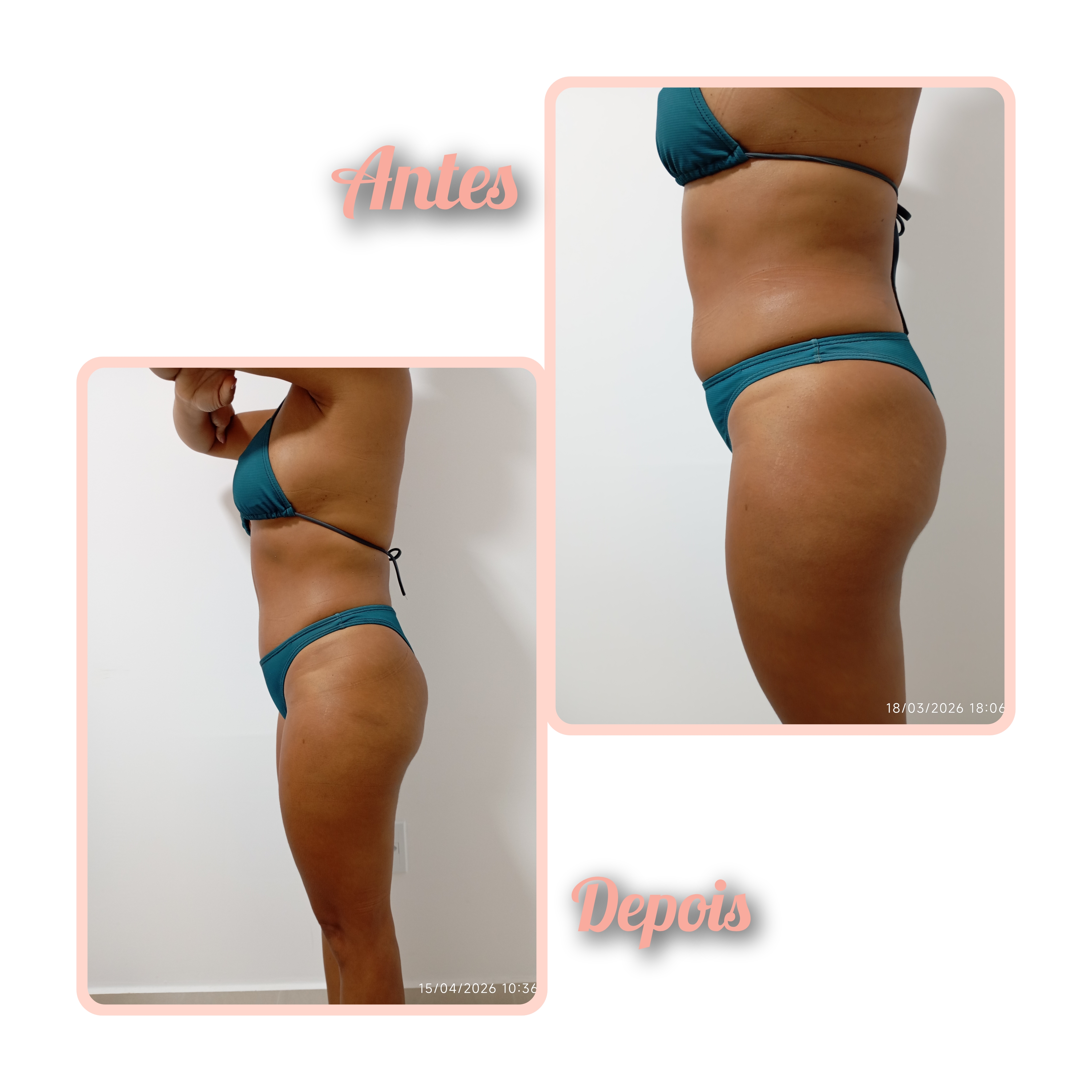 Studio Eliene (Massagem modeladora + eletroterapia localizada) — foto 3