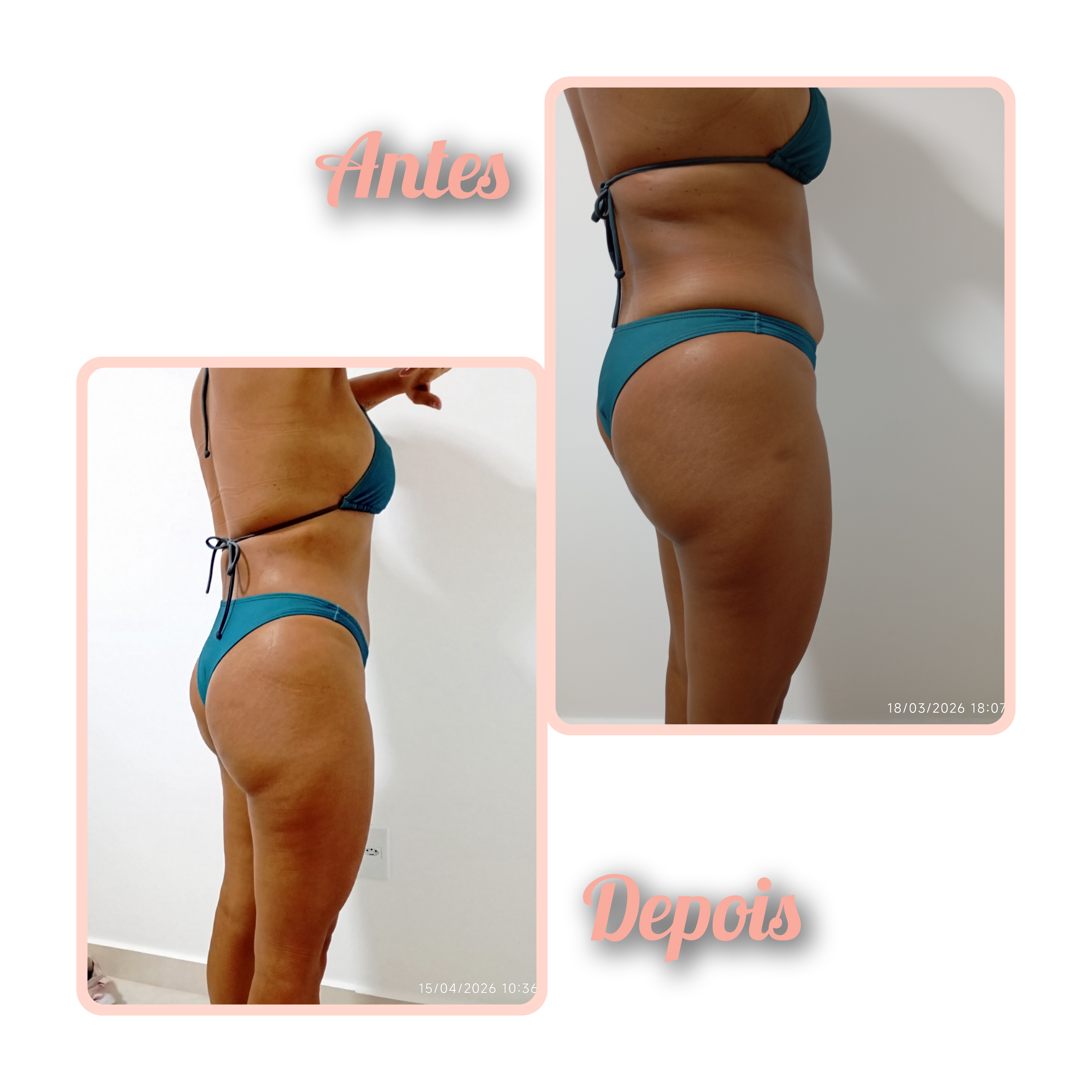 Studio Eliene (Massagem modeladora + eletroterapia localizada) — foto 2