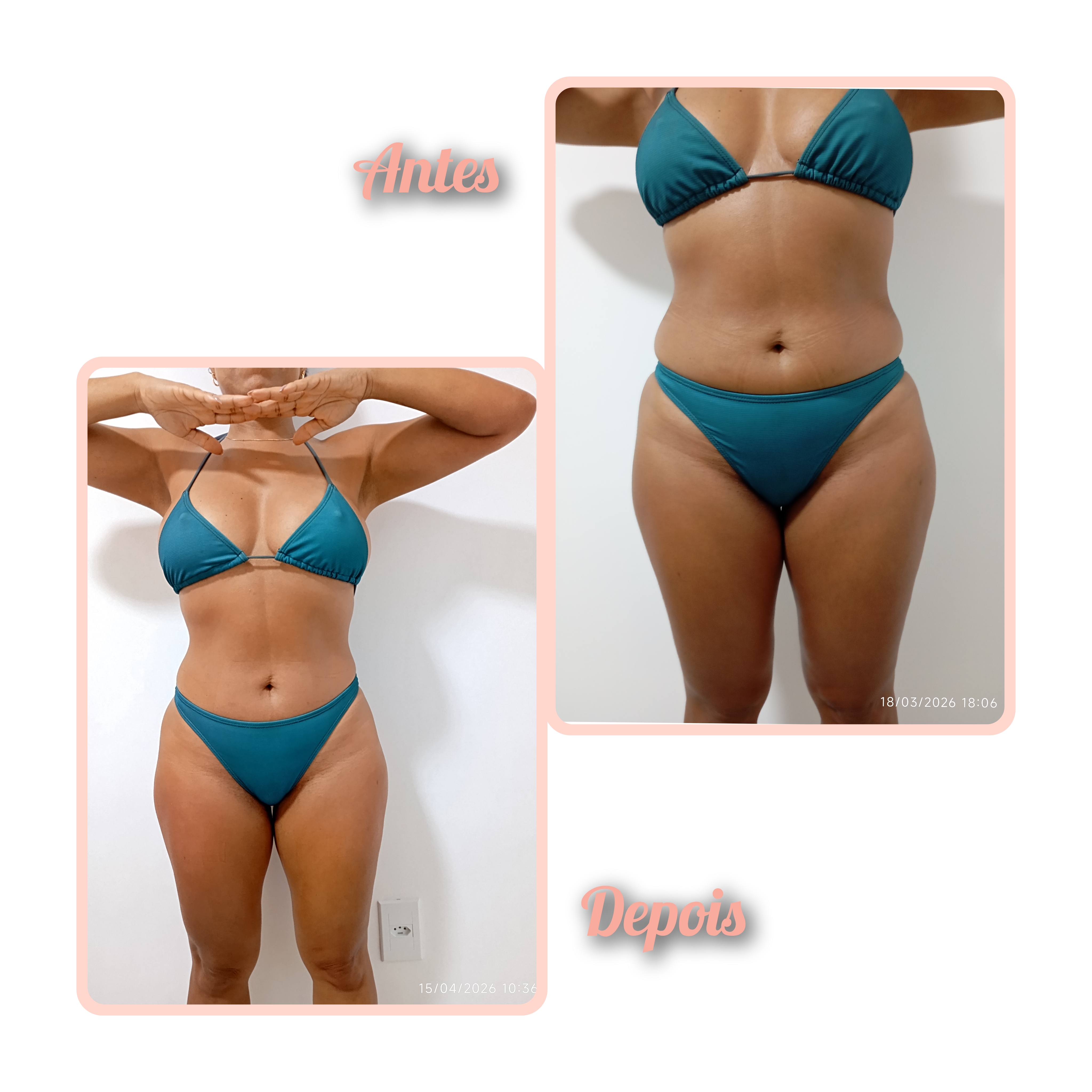 Studio Eliene (Massagem modeladora + eletroterapia localizada) — foto 4