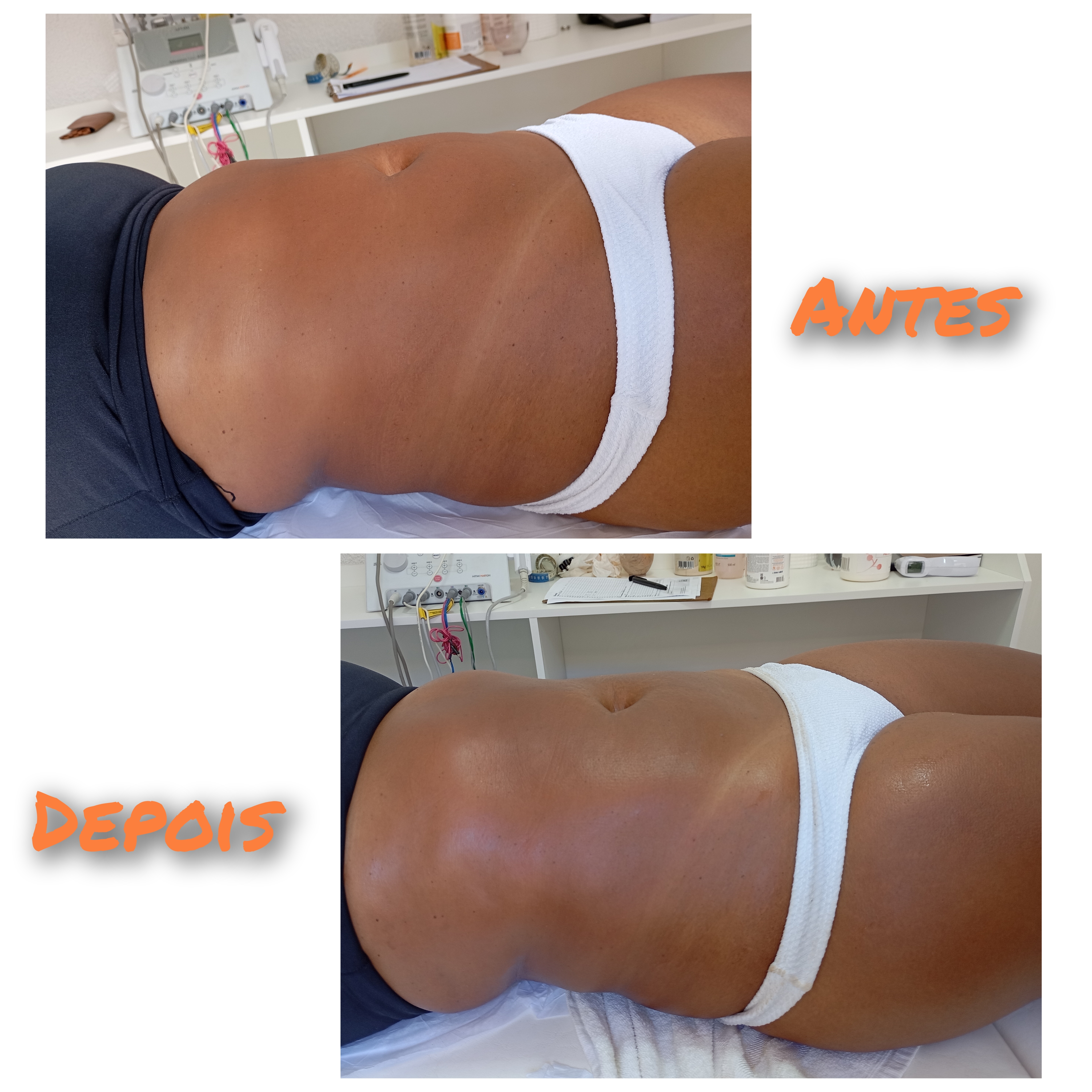 Studio Eliene (Massagem modeladora + eletroterapia localizada) — foto 6